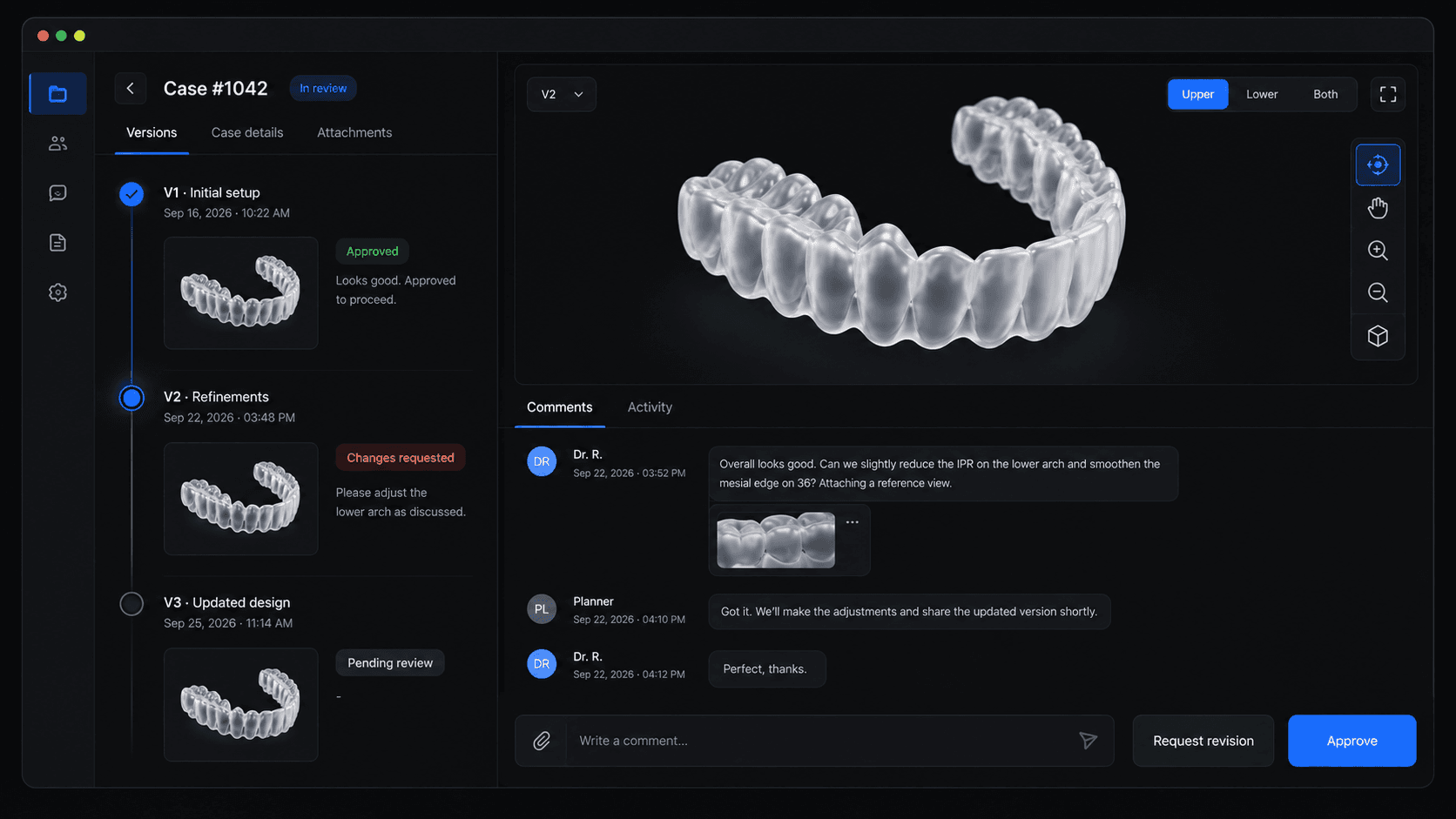 Case review with approve and request-revision actions